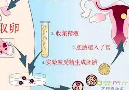 揭秘！针灸如何微妙影响试管着床？专家建议必读